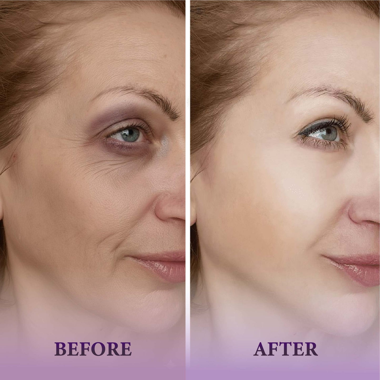 Zilka Bio Collagen Mask for Face (Pack of 8)